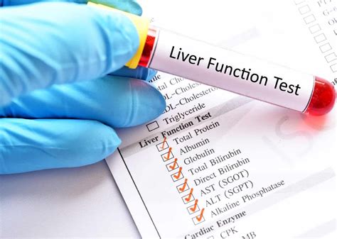 exercise and liver function test